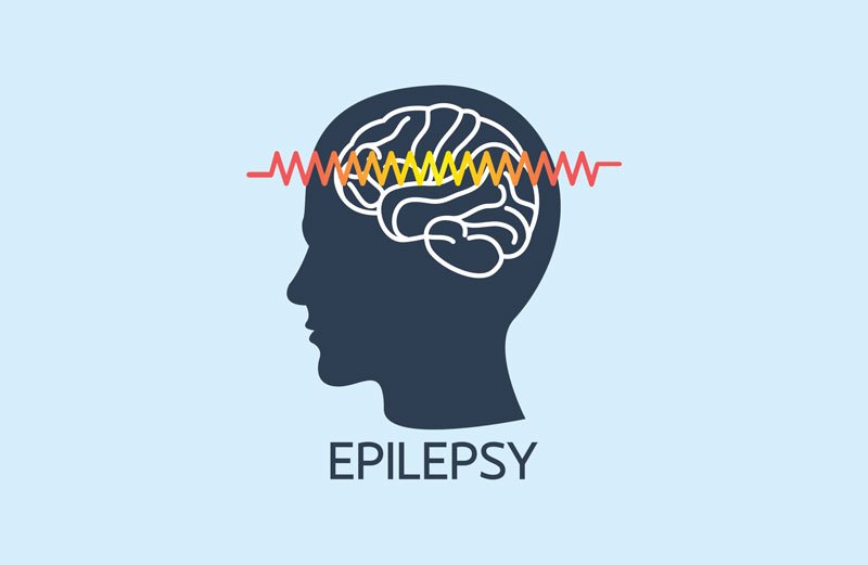 Epilepsy & CBD